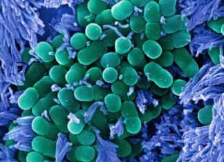 Recall Alert: Over 100,000 Pounds of Ground Beef Recalled for E. coli Concerns news-22112024-165031