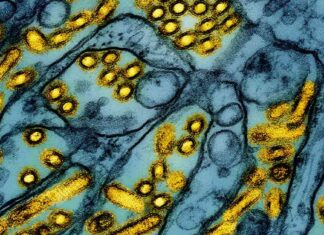 Bird Flu Outbreak: US Reports First Death – Latest Updates bird-flu-outbreak-us-reports-first-death-latest-updates