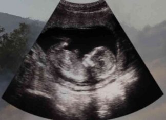 Should Pregnant People Evacuate Los Angeles to Avoid Smoke Exposure? should-pregnant-people-evacuate-los-angeles-to-avoid-smoke-exposure