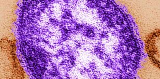 stay-safe-get-vaccinated-before-summer-travel-amid-measles-surge