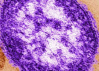 Stay Safe: Get Vaccinated Before Summer Travel Amid Measles Surge stay-safe-get-vaccinated-before-summer-travel-amid-measles-surge